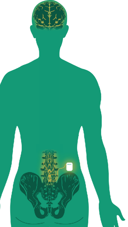 body
